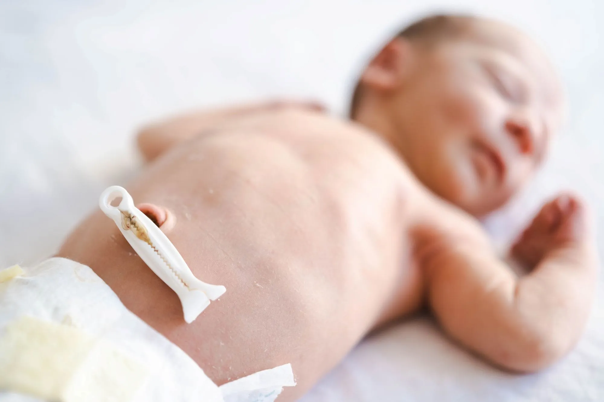 Umbilical Cord Care | Newborn Umbilical Stump and Belly Button